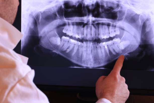 Best Emergency Dental Extractions in Lawtey, FL