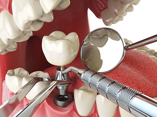Best Emergency Cosmetic Dentistry in Lawtey, FL